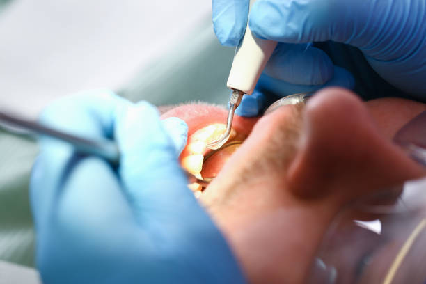 Best Knocked-Out Tooth Emergency  in Christmas, FL